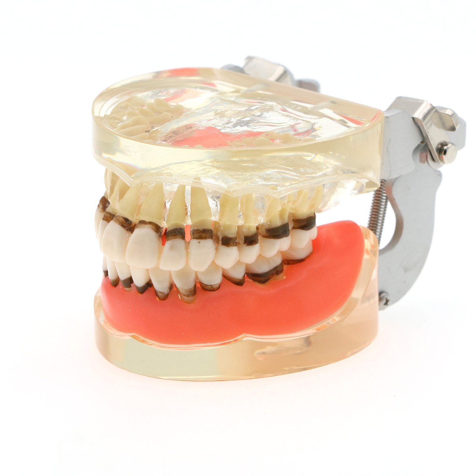 Multiple Types Dental Teeth Model Typodont Ortho Implant Practice Demo Teaching