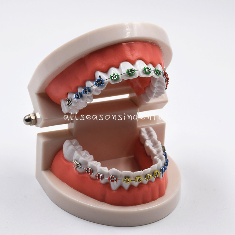 Dental Orthodontic Standard Teeth Model With Brackets Buccal Tube Ligature Ties