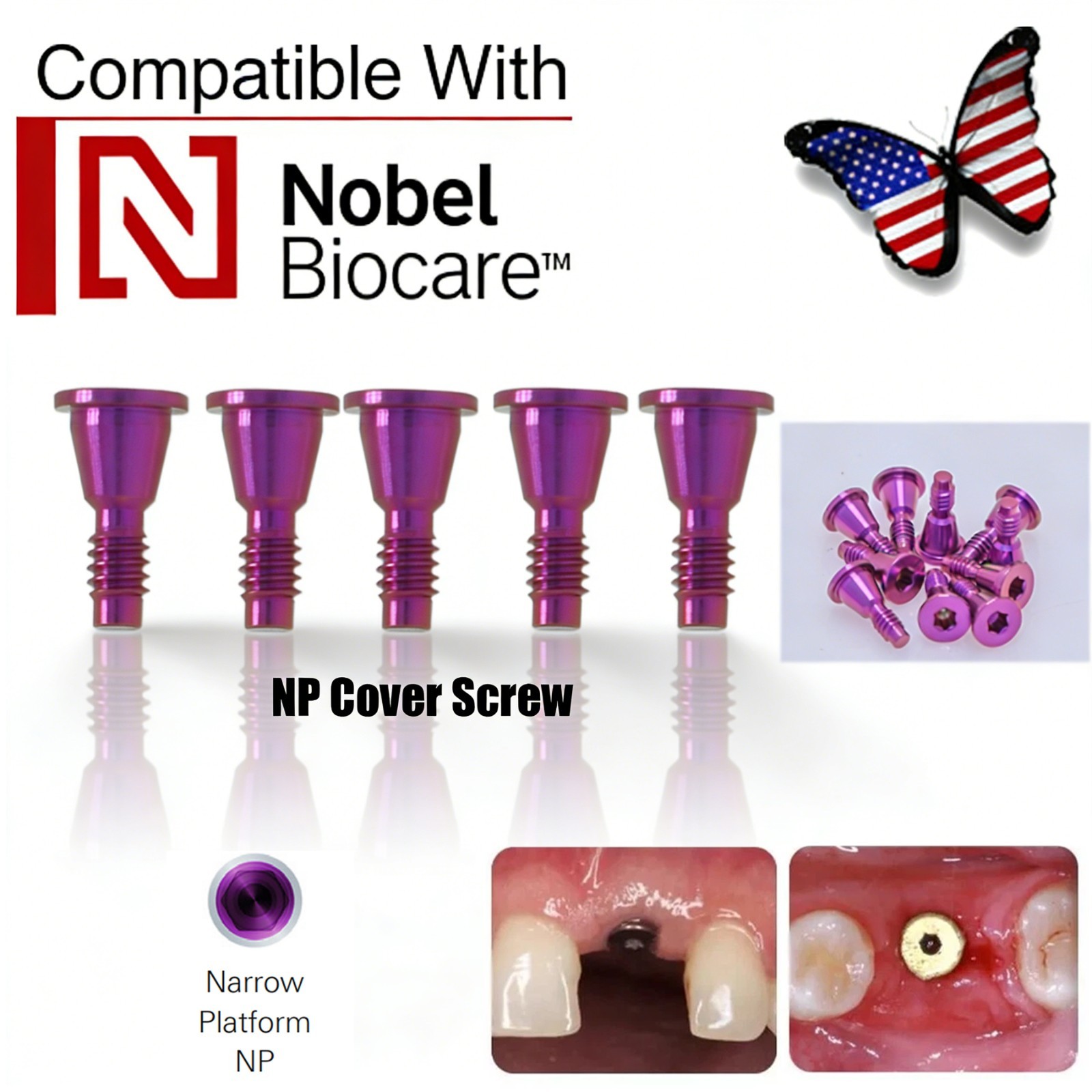US Dental Cover Screw For Nobel Biocare NP RP Implant Conical Connection Healing