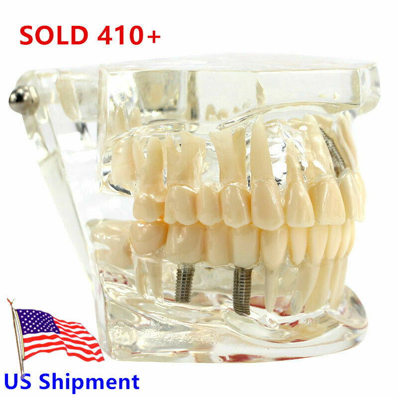 Dental Fake Teeth Study Model Implant Disease Education Denture Teach Analy