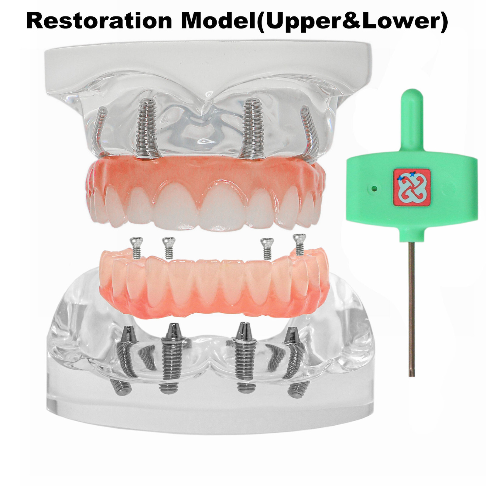 Implant Typodont Teeth Restoration Model Overdenture Practice Demo Series Dental