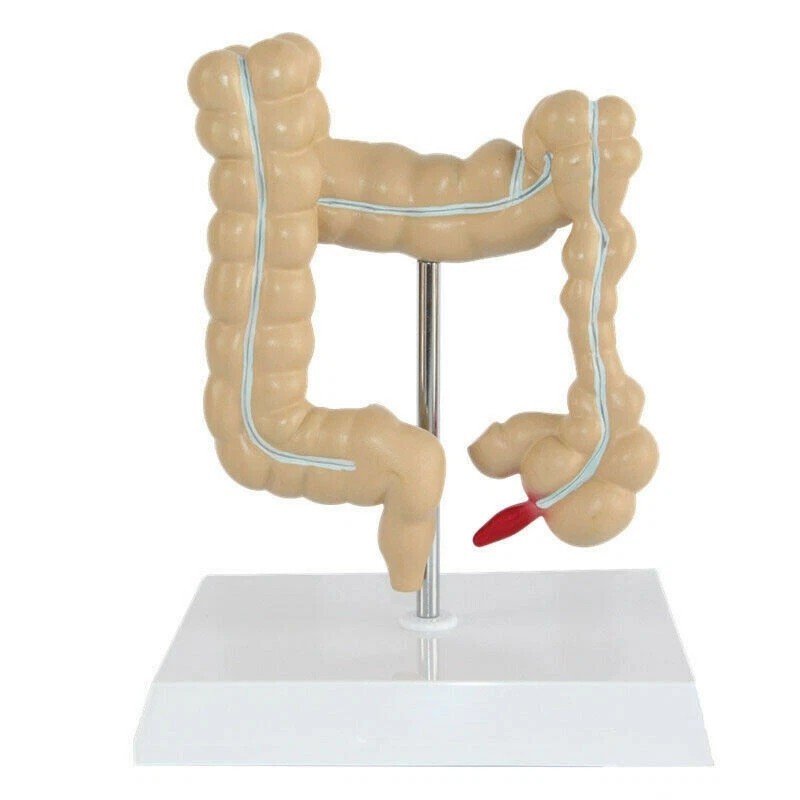 Anatomical Human Colon Intestine Pathological Diseases Model Medical Anatomy