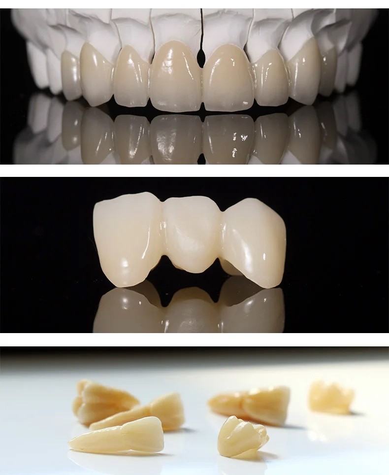 Dental C14 MT Lithium Disilicate Glass Ceramic Blocks A1–BL4 CAD/CAM 5pcs/Box