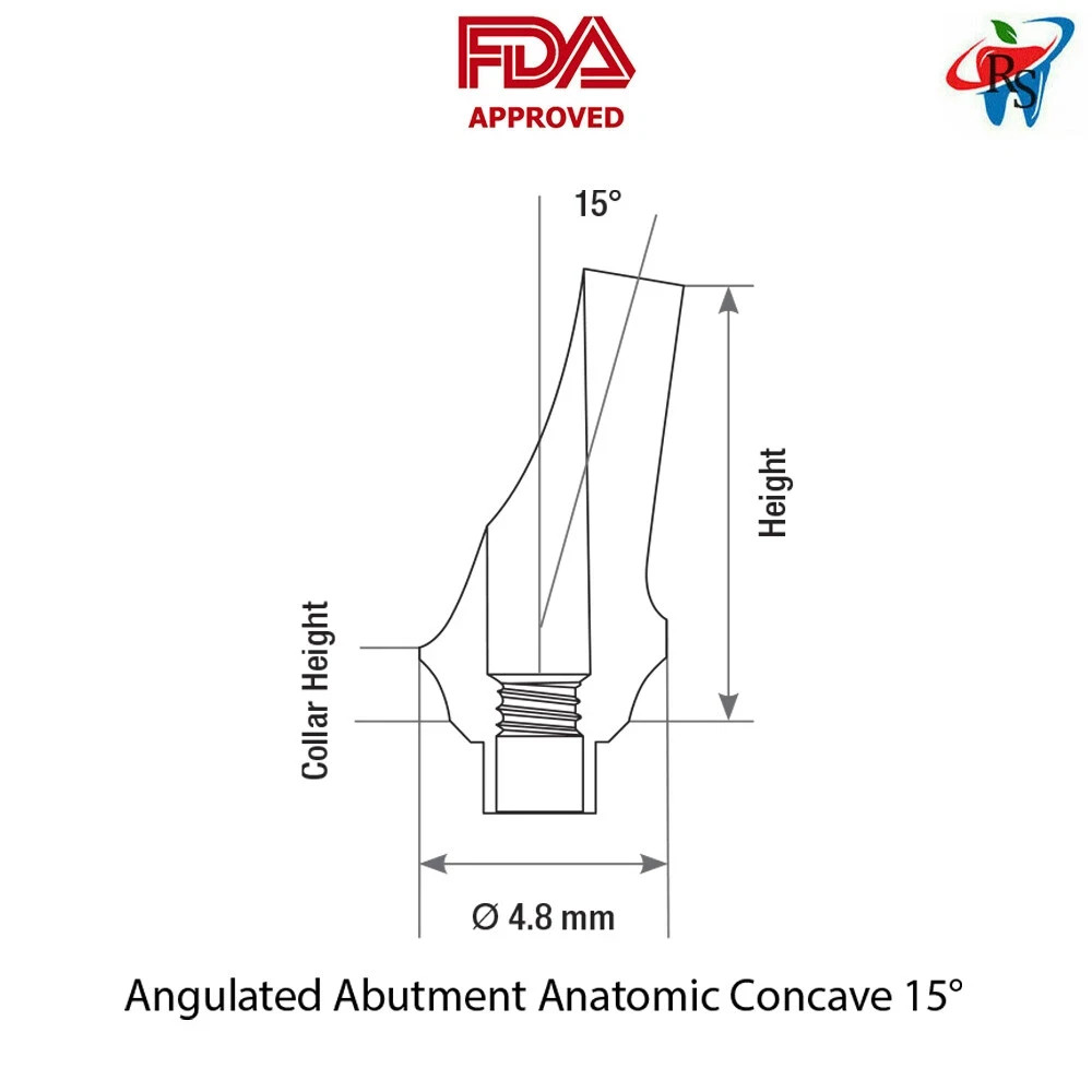 1pcs Abutments Concave Anatomic Angulated 15° Titanium Int Hex 1-4mm