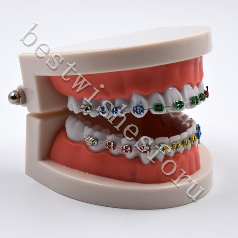Dental Orthodontic Standard Teeth With Metal Brackets Ligature Ties Hoop Model