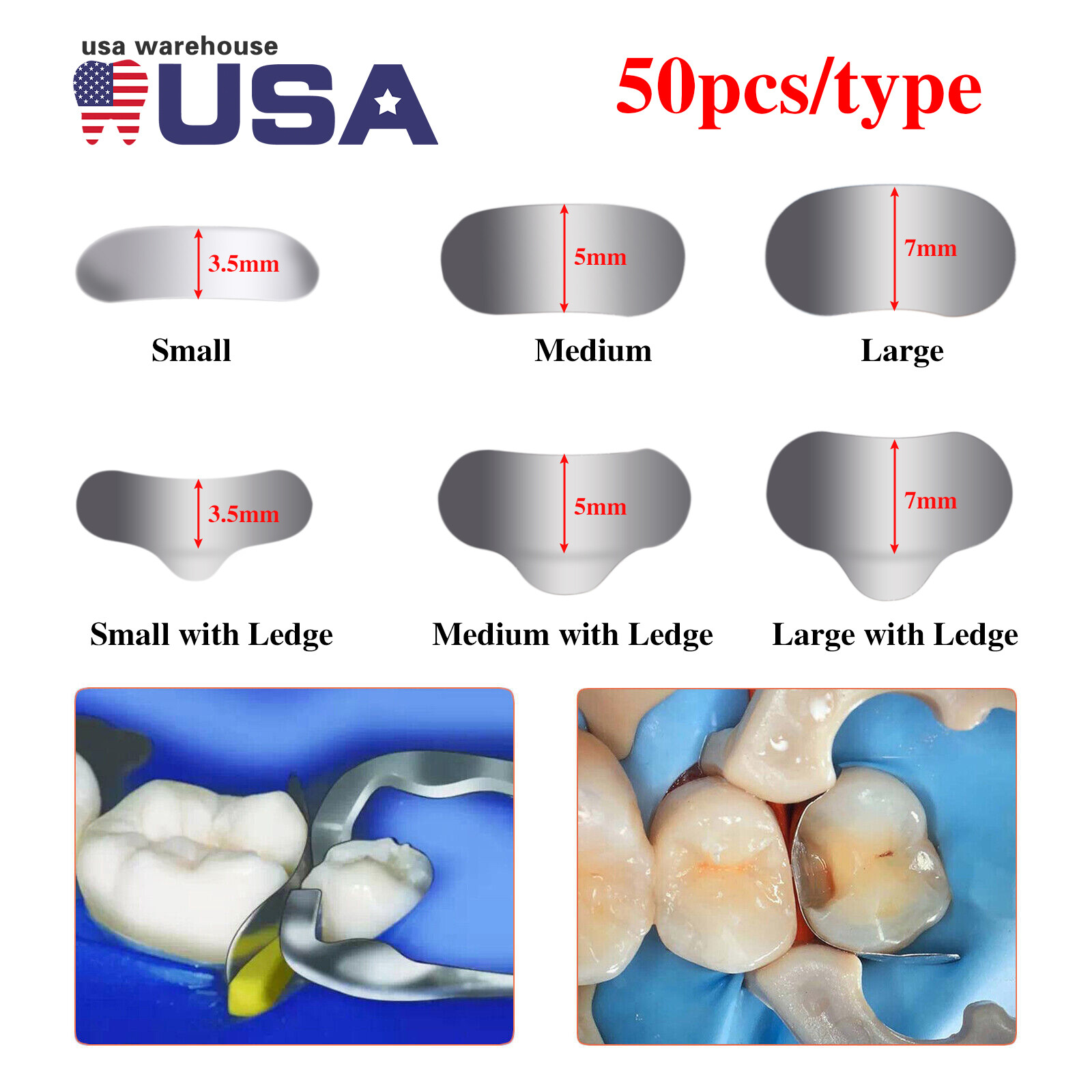 Dental Sectional Matrix System Contoured Metal Matrices Refill Matrix Bands 50x