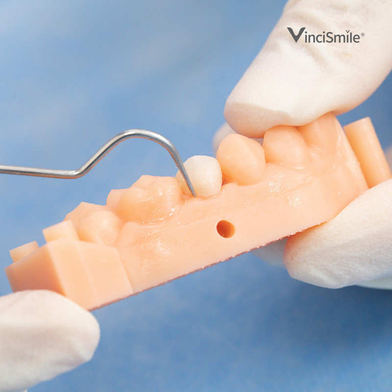 Dental Veneer Cementation Kit:2 Etching Gel/10 Veneer Cement/1 Adhesive/1 Primer