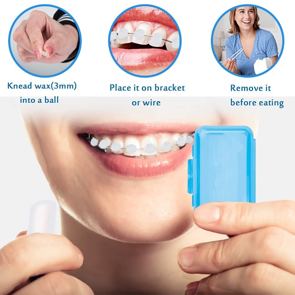 Orthodontic Dental Wax 6 Pack Colorful for Braces and Appliances Pain Relief