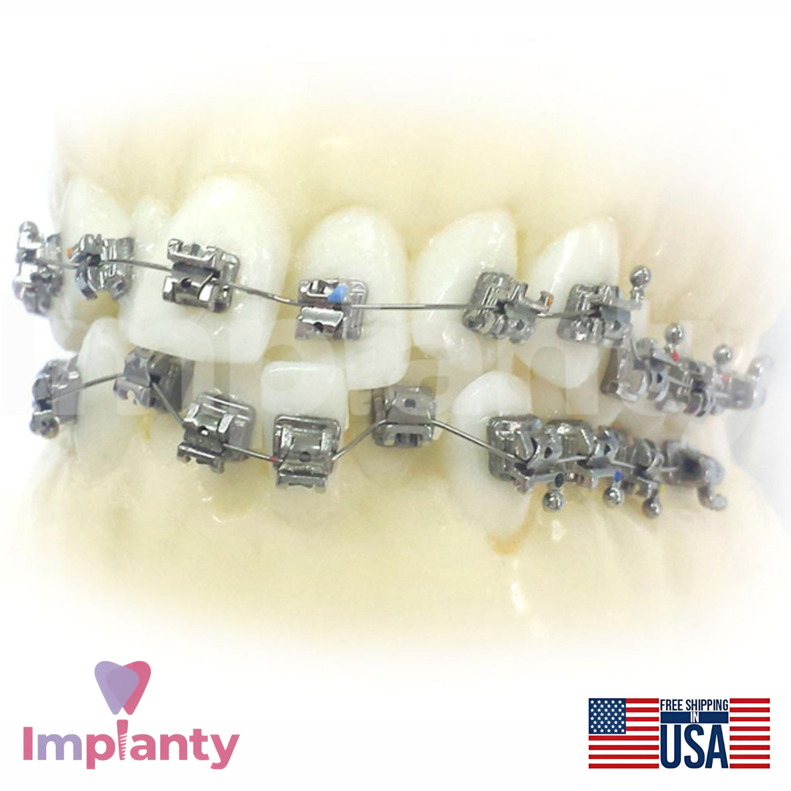 Morelli NiTi Thermo Copper CuNiTi IntraoraI Round Archwire Dentistry Tool 10pcs