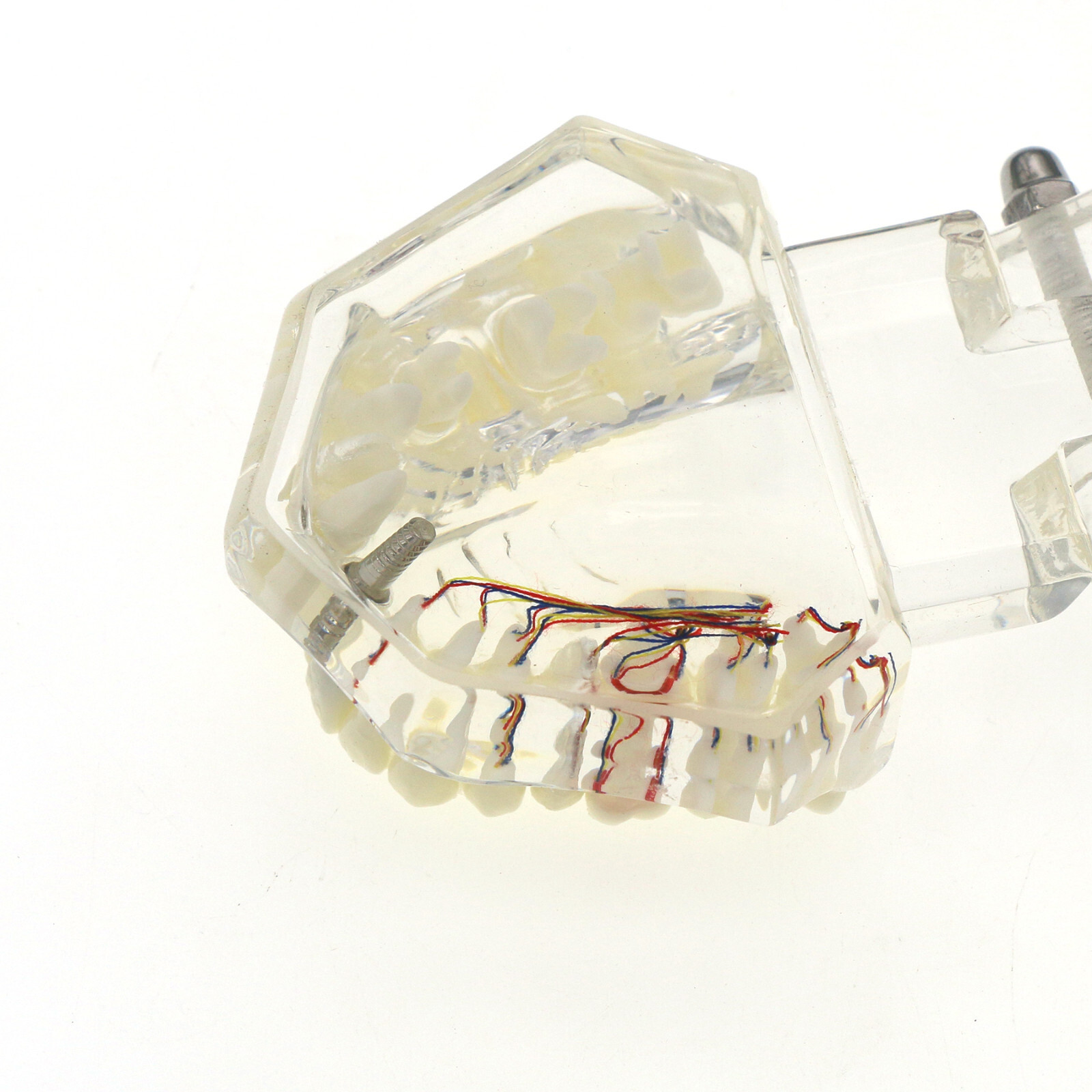 Dental Oral Typodont Model Implant Pathological Removable Teach Visible Anatomy