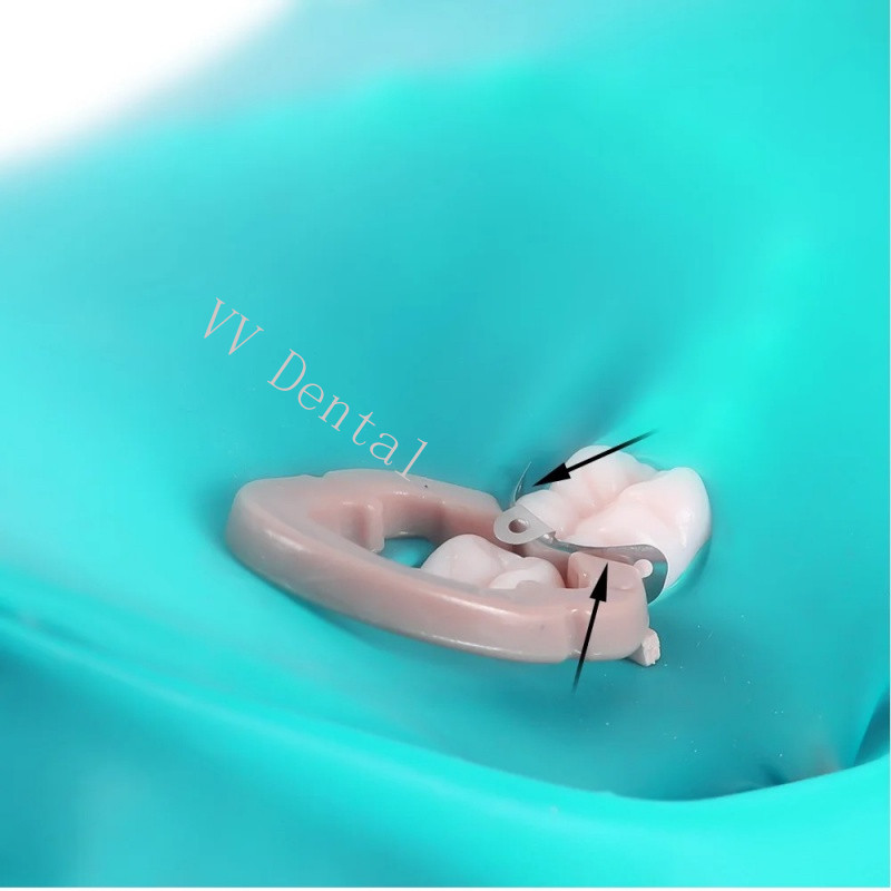 50pcs/box Dental Matrix Bands Palodent Sectional Contoured Matrices Refill