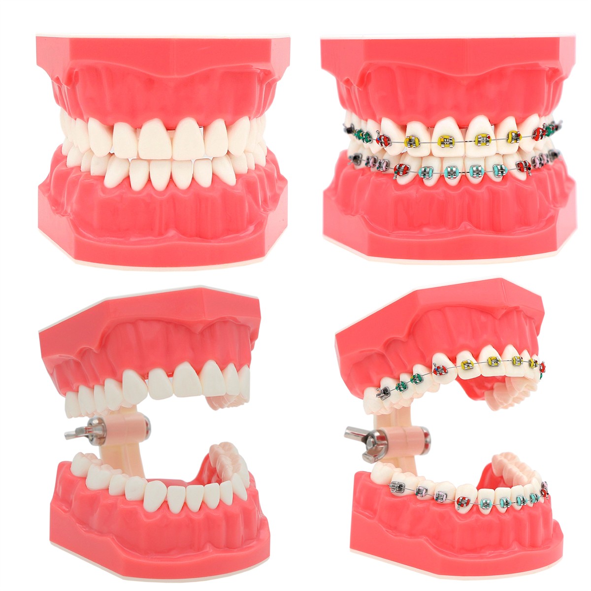 US Dental Typodont Teeth Model Implant Restoration Orthodontics Demo Teaching