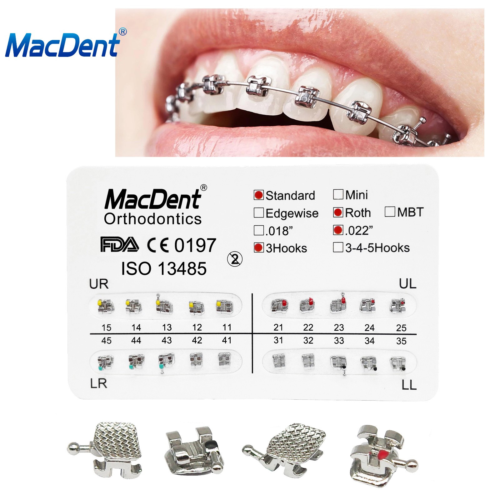 Dental Brackets /Orthodontic Light Cure Adhesive Kit/Blue Green Glue/Mini No-Mix
