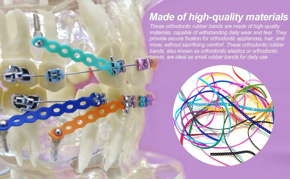 24 Pieces Colorful Power Chain Set (Continuous) for Braces, Fashion colorful