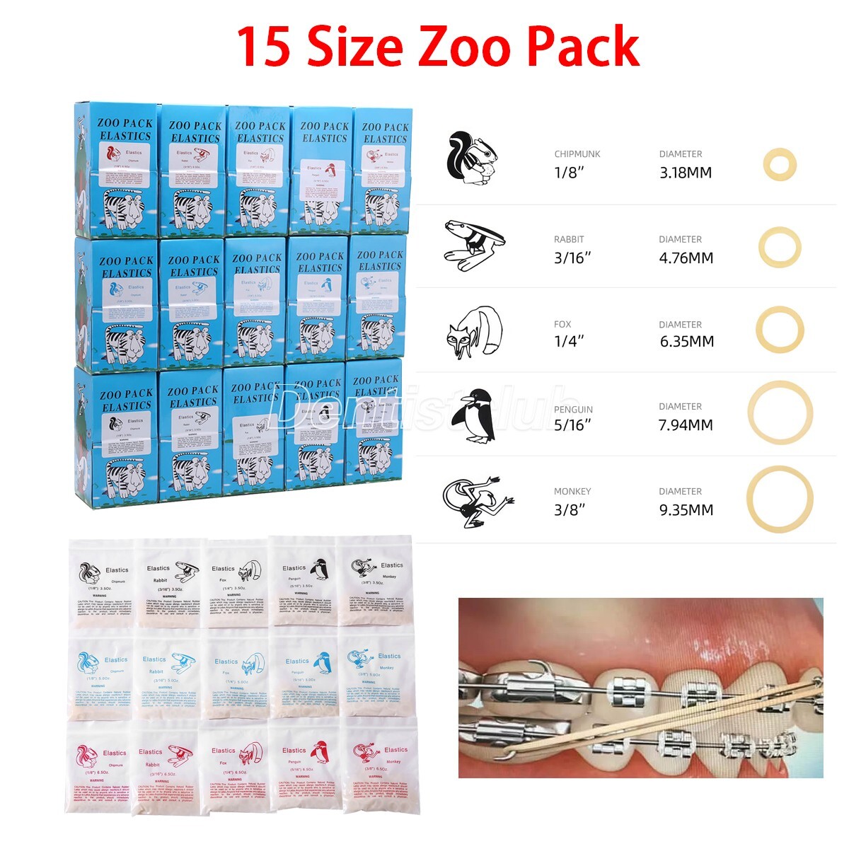 USA Dental Orthodontic Elastic Rubber Bands Latex Braces 3.5/5.0/6.5 OZ Zoo Pack