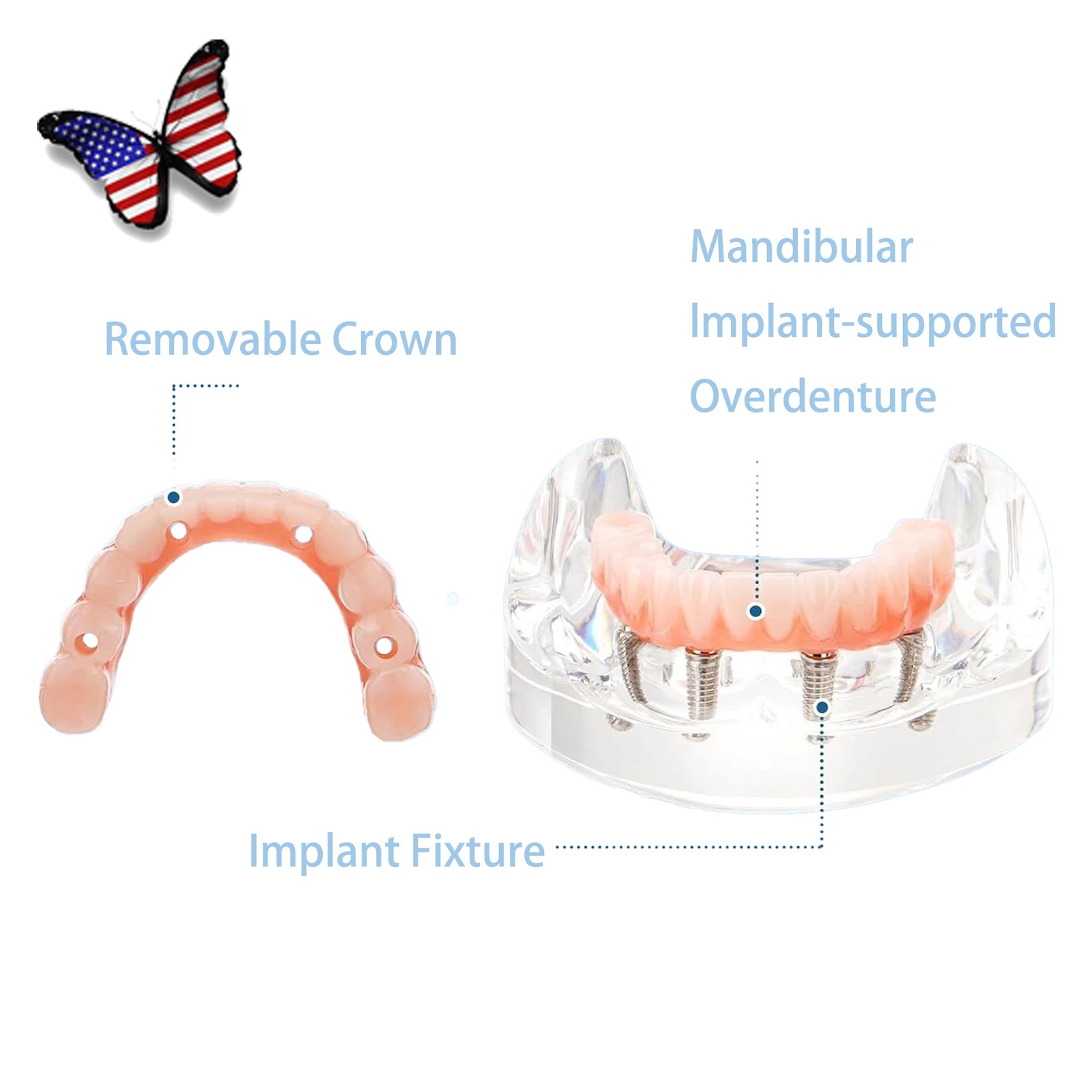 US Dental Overdenture/Implant/Orthodontic Typodont Ortho Training Teaching Model
