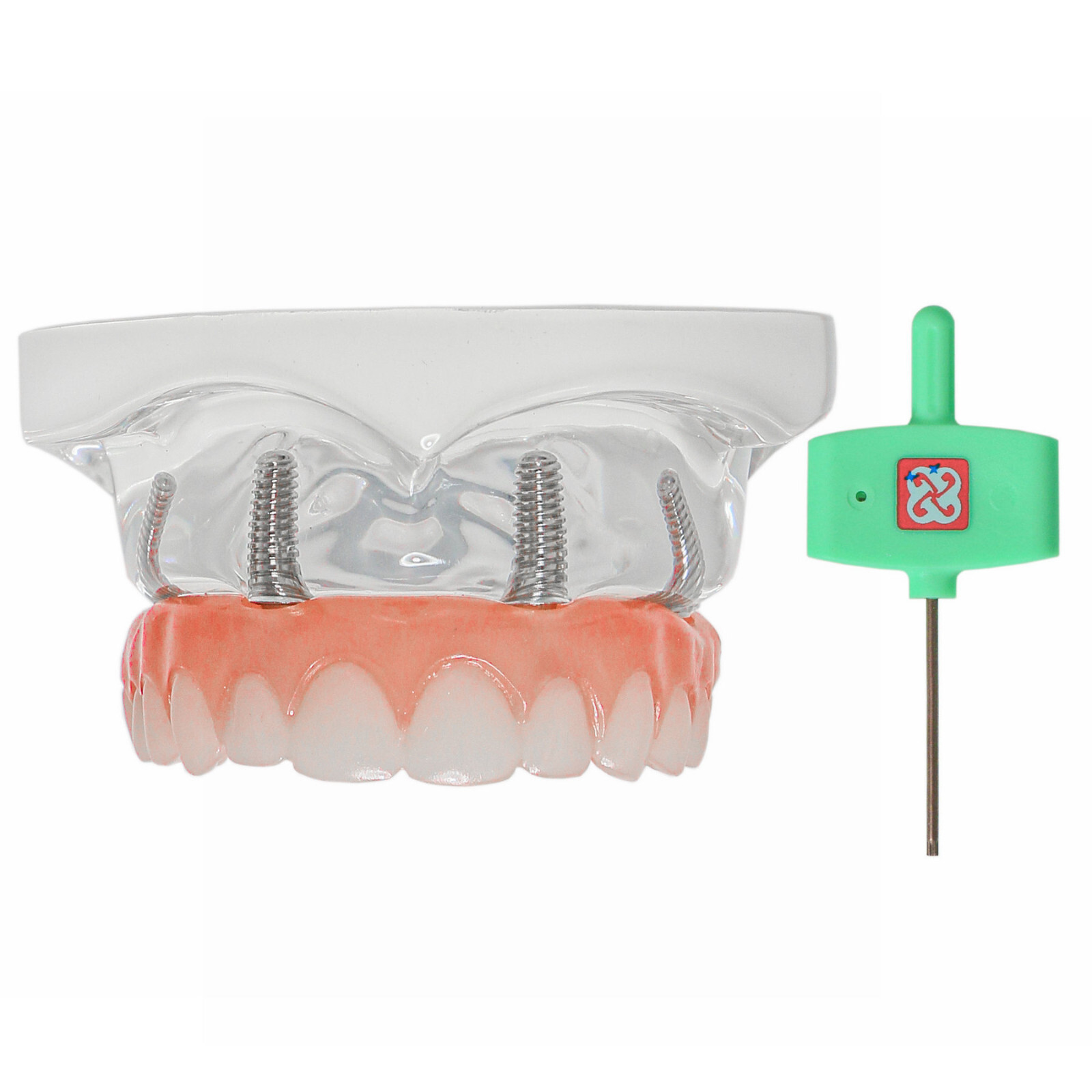 Dental 4 Implants Demo Implant Teeth Model Restoration Overdenture Upper/Lower
