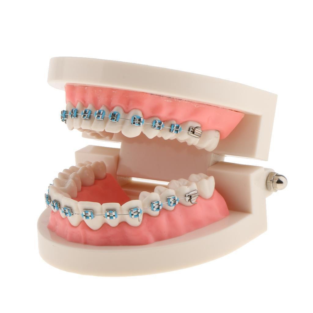 Dental Metal Model Orthodontic Adult Standard Teeth Hoop Brackets Ligature Tie