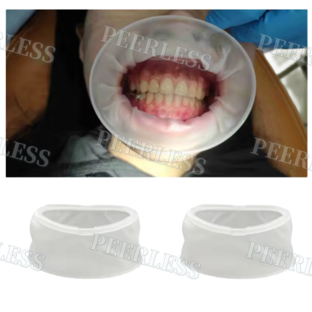 Dental Mouth Opener Lip Cheek Retractors O Shape Intraoral Lip Expander Opener M