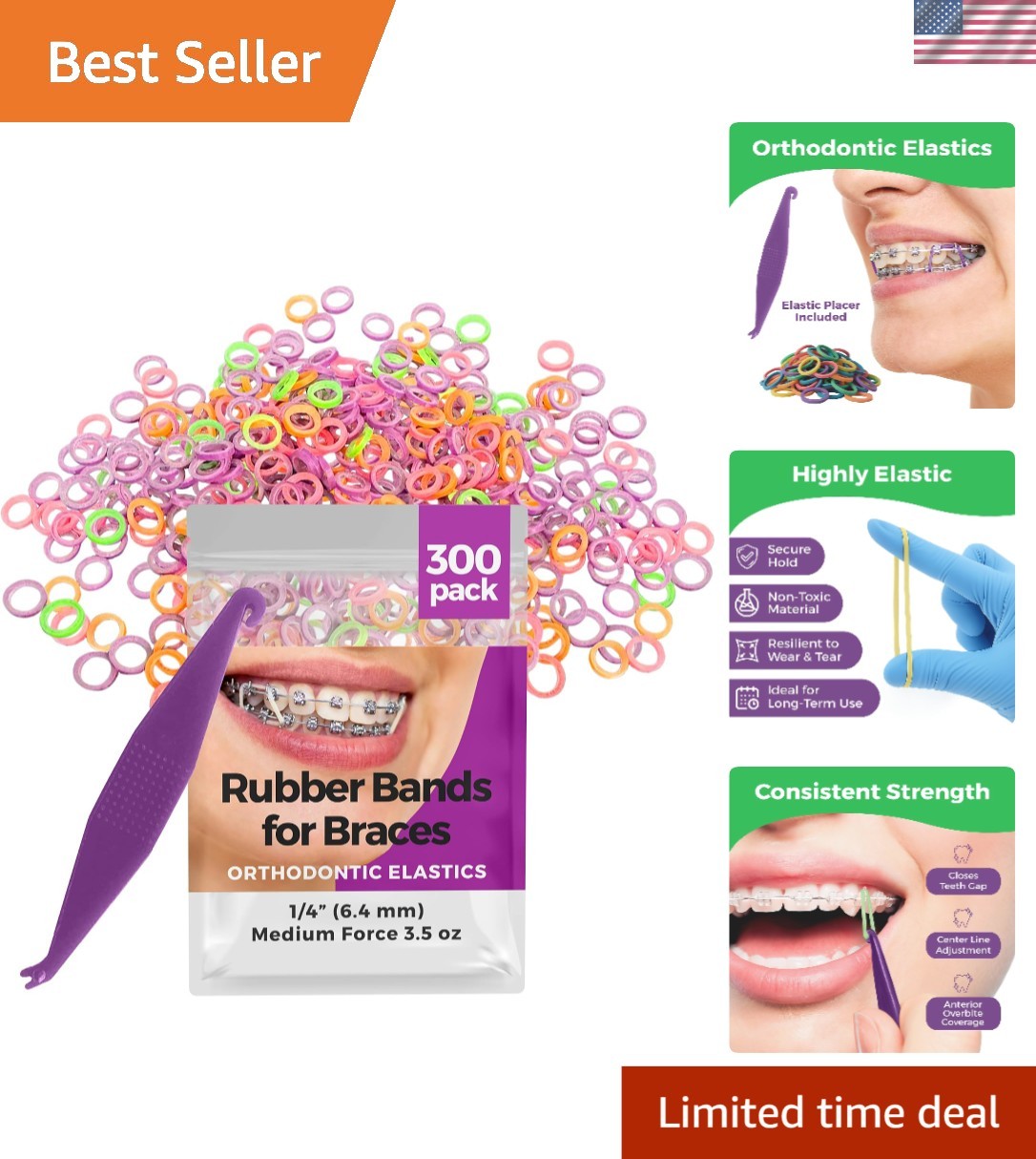 Durable Neon Rubber Bands for Braces 300 Pack – Perfect for Orthodontics & Hair