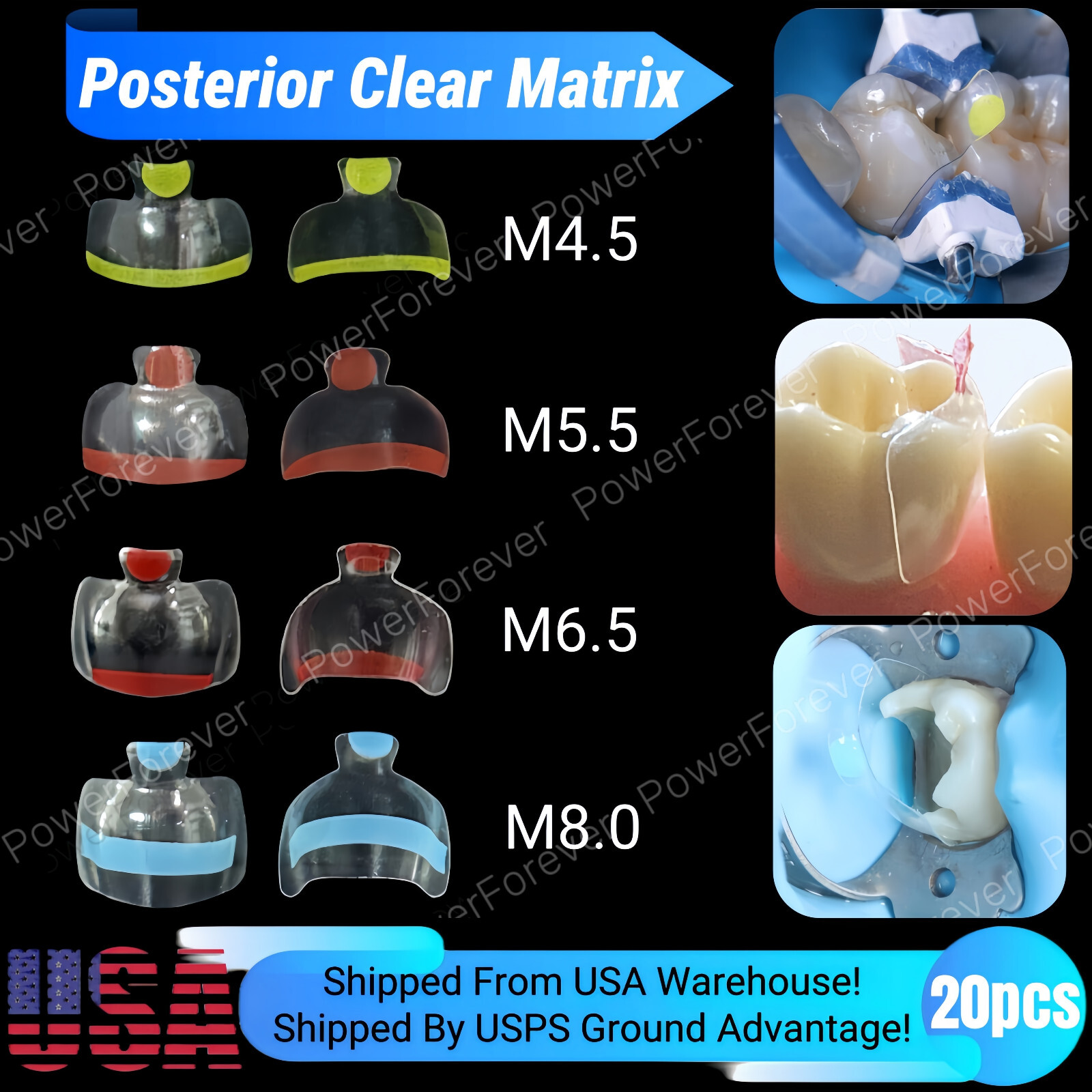 20pcs Dental Posterior Clear Matrix Molar Restorative Matrices BT Fit BioClear