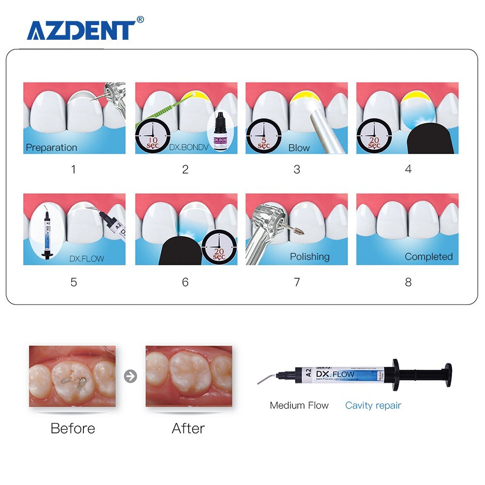 DENTEX Dental Flowable Light Cure Composite Resin Medium Flow A2 Shade