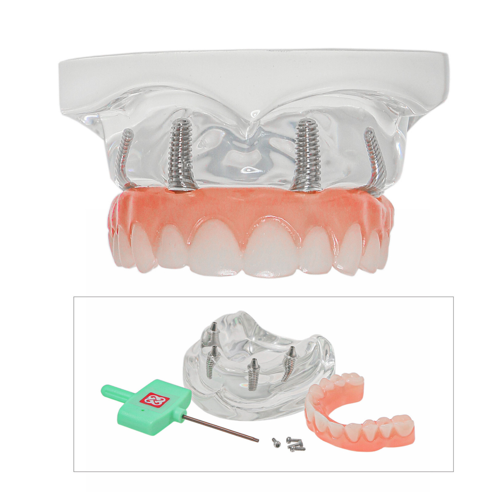 US Dental Overdenture All-on-4 Model Upper/Lower Jaw-Clear Implant With 4 Screws