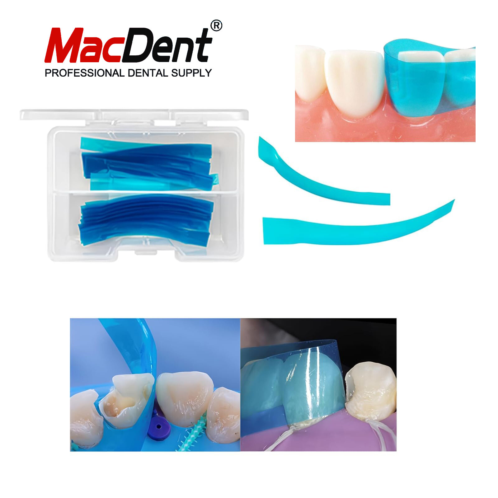 Dental Blue View Strip Anterior Restoration Strips Composite BT Clear Matrix