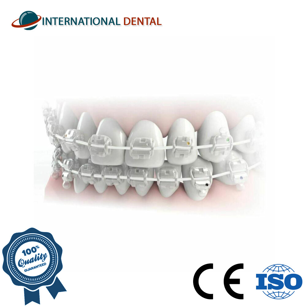 Orthodontic Dental Aesthetic Super Elastic Intraoral Archwire NiTi Rectangular