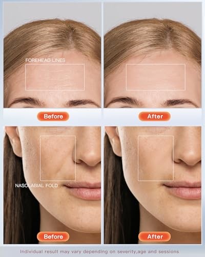 NEWKEY 4D LED Red Light Therapy Mask for Face Skin 1 Count (Pack of 1)