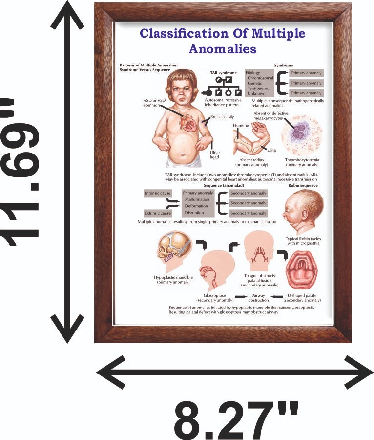 Classification Of Multiple Anomalies Chart 12×18 inches