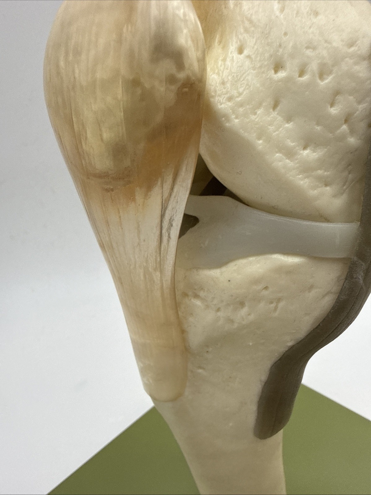 Somso NS50 Functional Knee Joint with Ligaments Anatomical Model NS 50