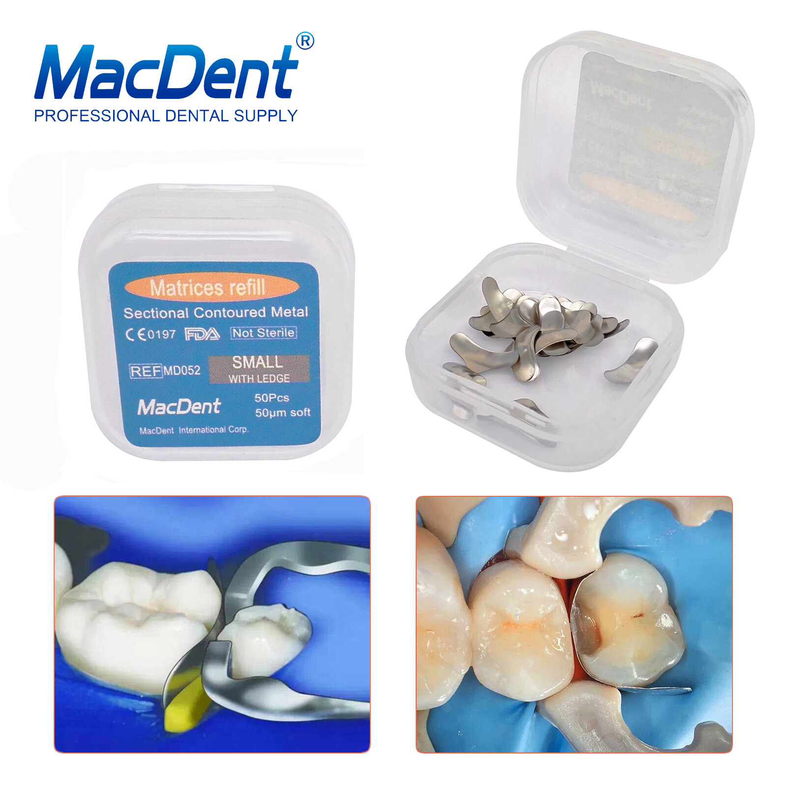 50Pcs/box MacDent Dental Sectional Contoured Matrices Matrix Bands Refill S/M/L