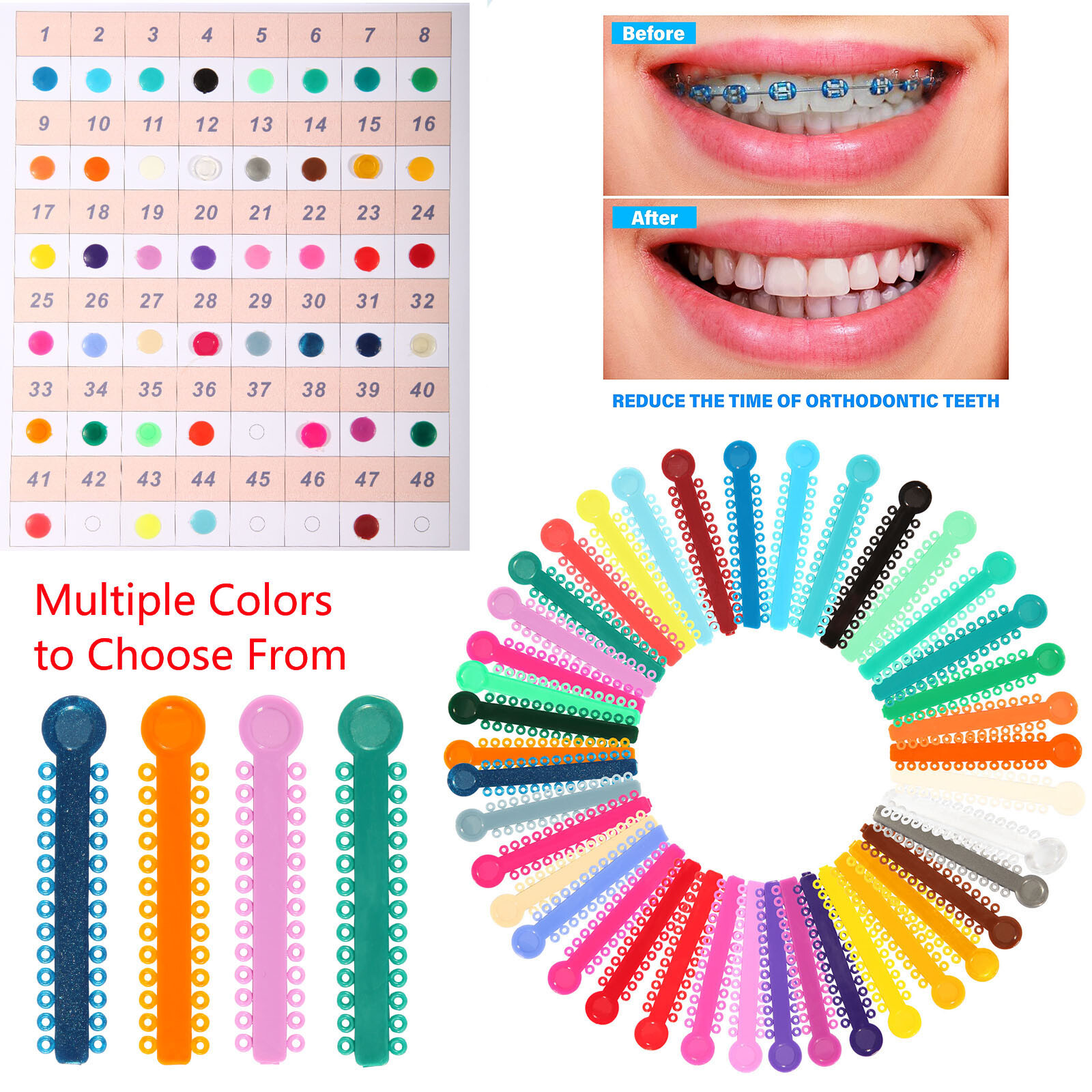 1040 pcs Dental Orthodontic Ligature Ties Elastic Bands for Brackets 43 Colors