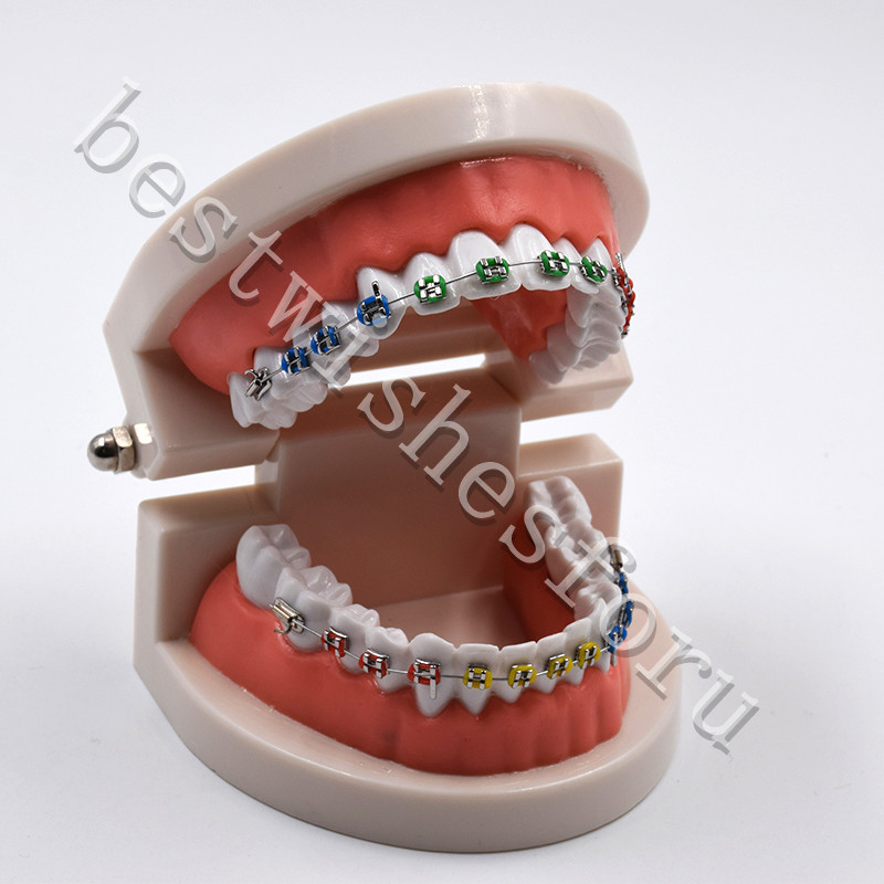 Dental Orthodontic Standard Teeth With Metal Brackets Ligature Ties Hoop Model