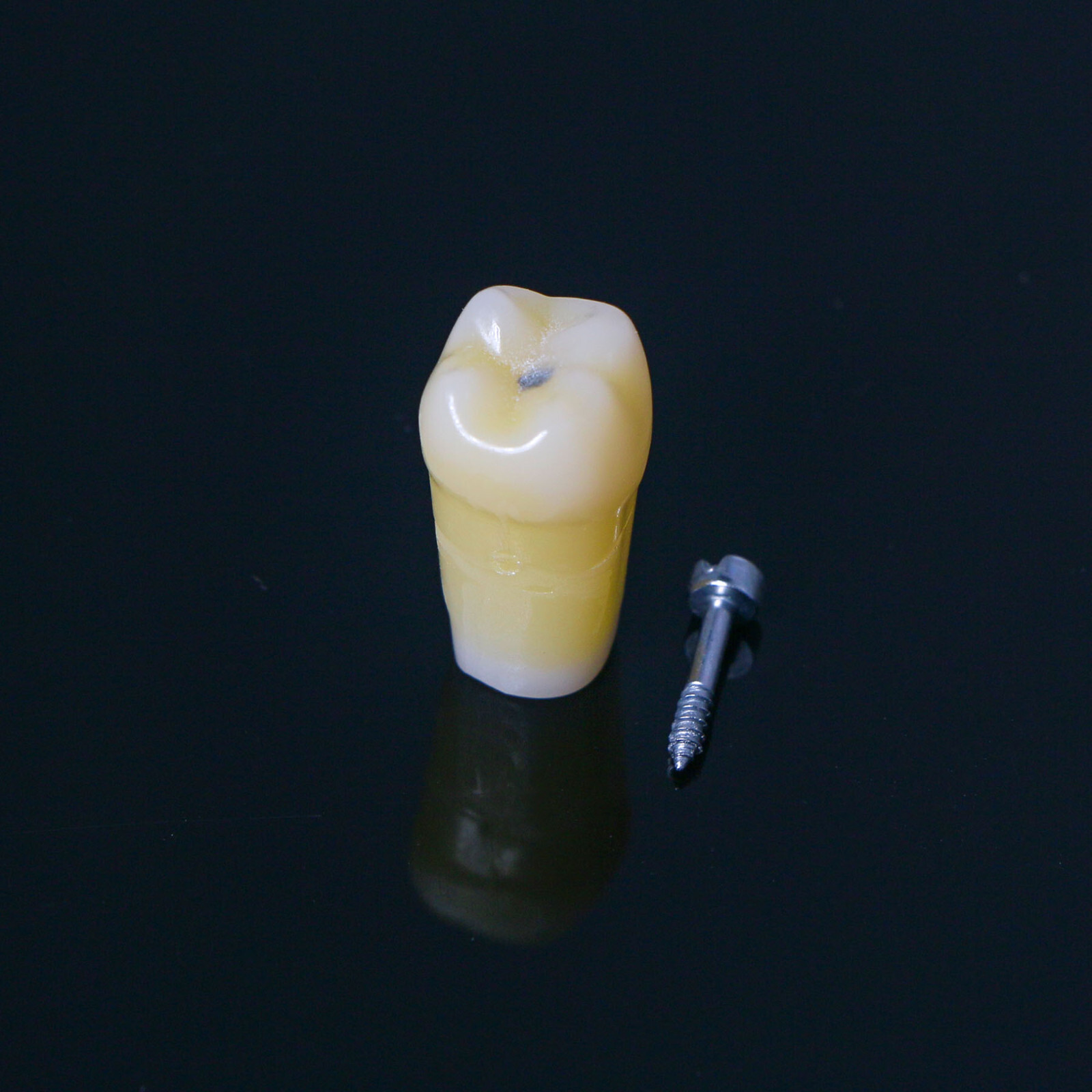 Dental Typodont Teeth Model with Caries Spots 28 Pieces Fits Kilgore Nissin 200