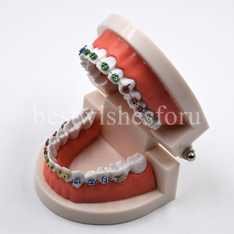 1*Dental Orthodontic Standard Teeth Tooth Model Metal Brackets & Ligature Ties
