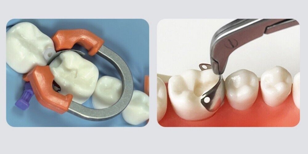 Universal Sectional Matrix Clamp Dental Matrix Bands Ring Nickel-Titanium Refill