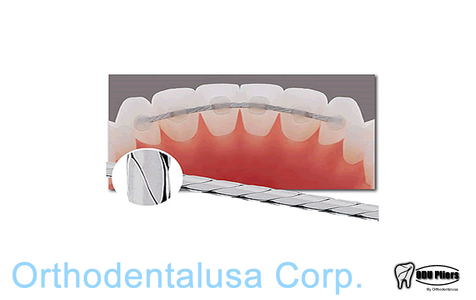 3-Strand Flat Lingual Retainer Wire – 010″x028″ 60 inch spool SS ORTHODENTALUSA