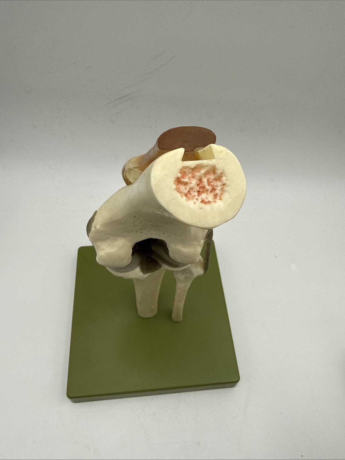 Somso NS50 Functional Knee Joint with Ligaments Anatomical Model NS 50