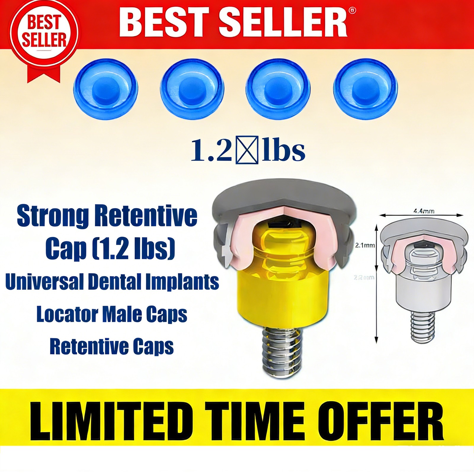 Dental Overdenture Zest Locator Abutment Legacy Anchor Hiossen Nobel Zimmer Cap