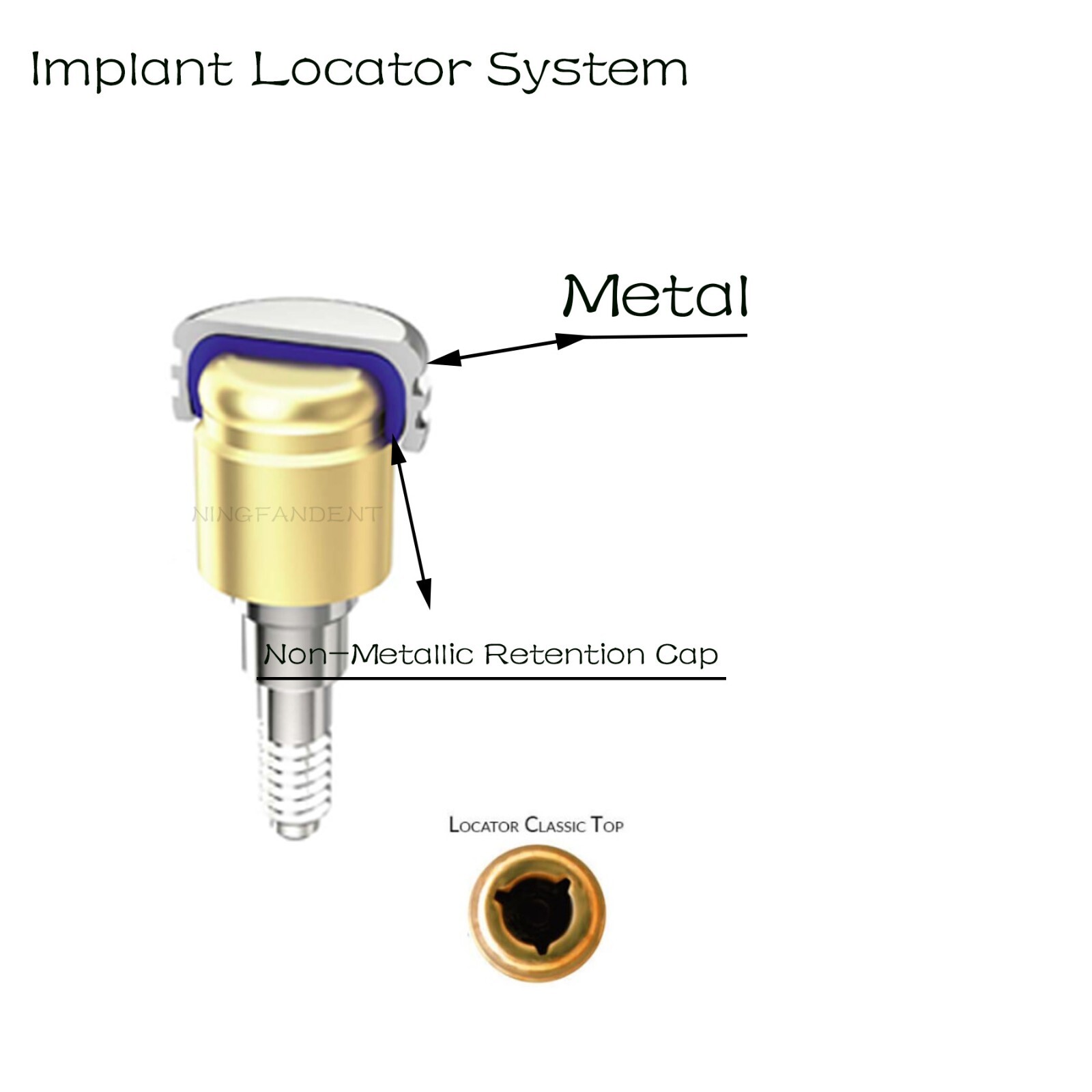 US Hiossen ET Implant Locator Abutment Classic for Zest Male Retention Inserts