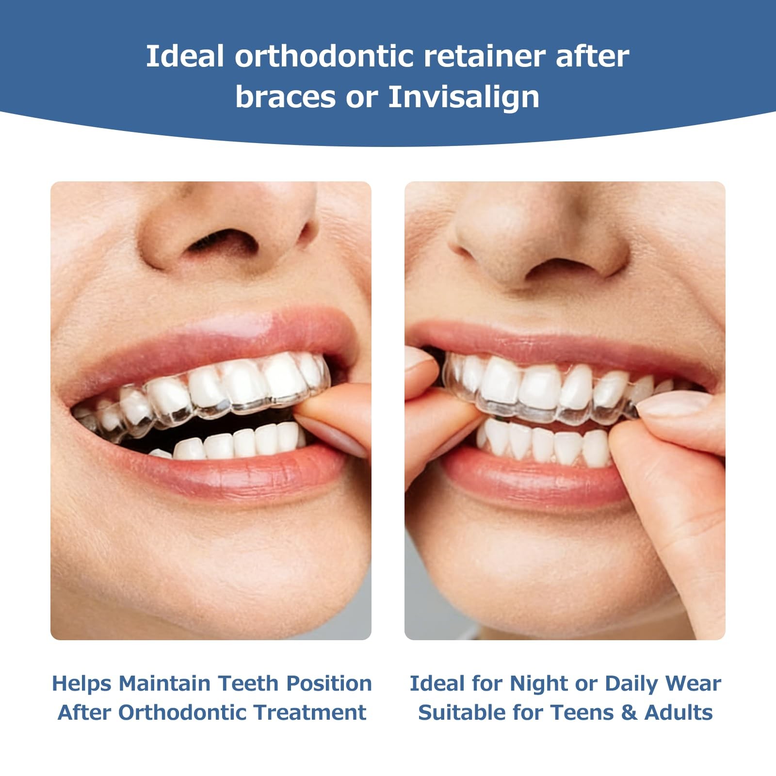 Custom Clear Retainers for Teeth, Upper & Lower Set – 1 Set,