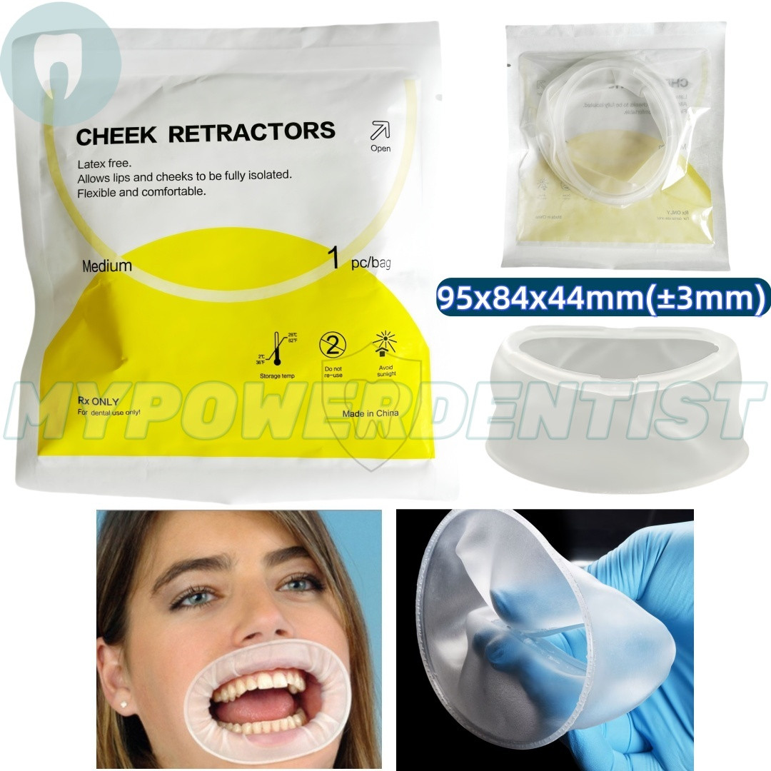 Dental Mouth Opener O Shape Lip Cheek Retractors Intraoral Lip Expander Opener