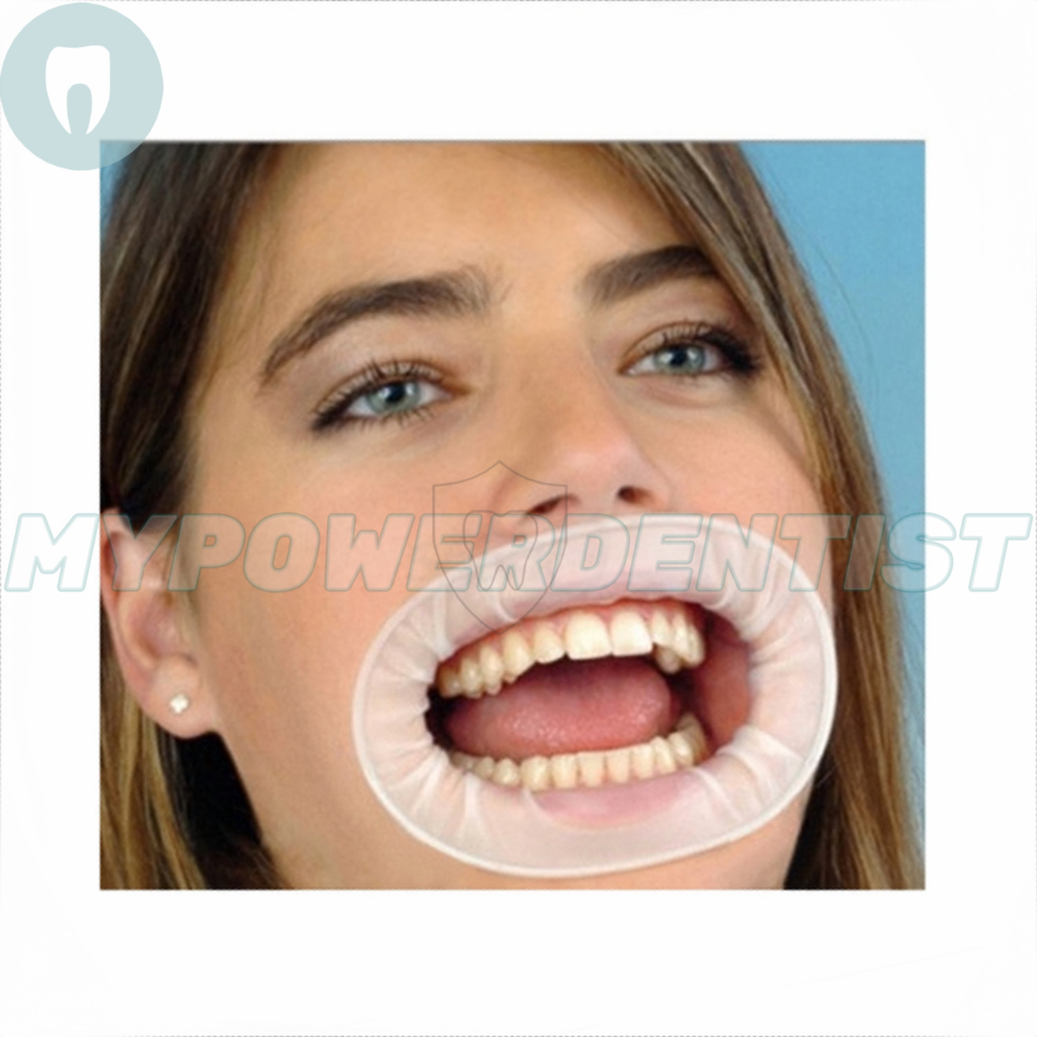 Dental Mouth Opener O Shape Lip Cheek Retractors Intraoral Lip Expander Opener