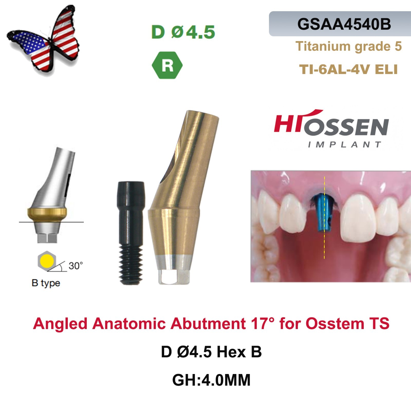US 5Pcs 17° Angled Anatomic Abutment Hiossen Osstem Mini Regular Hex Titanium