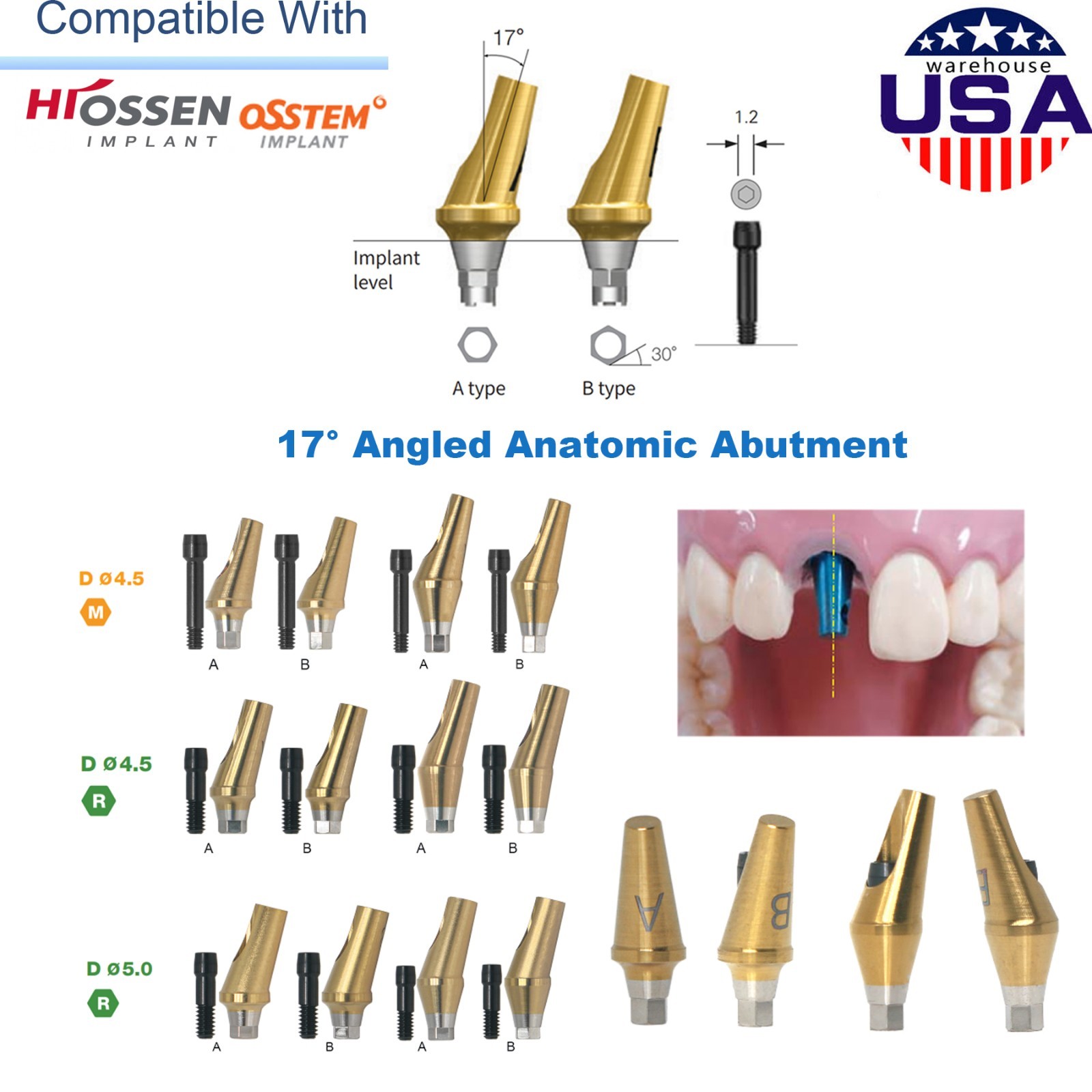 US 17° Angulated Abutment Mini/Regular Hex A/B Transfer Fit Osstem TS/Hiossen ET