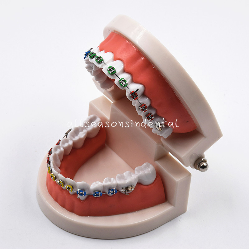 Dental Orthodontic Standard Teeth Model With Brackets Buccal Tube Ligature Ties