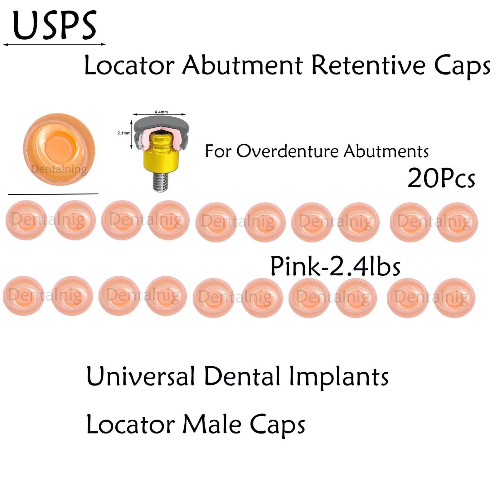 US Dental overdenture Locator Abutment Retention Caps Male Cap Inserts Set