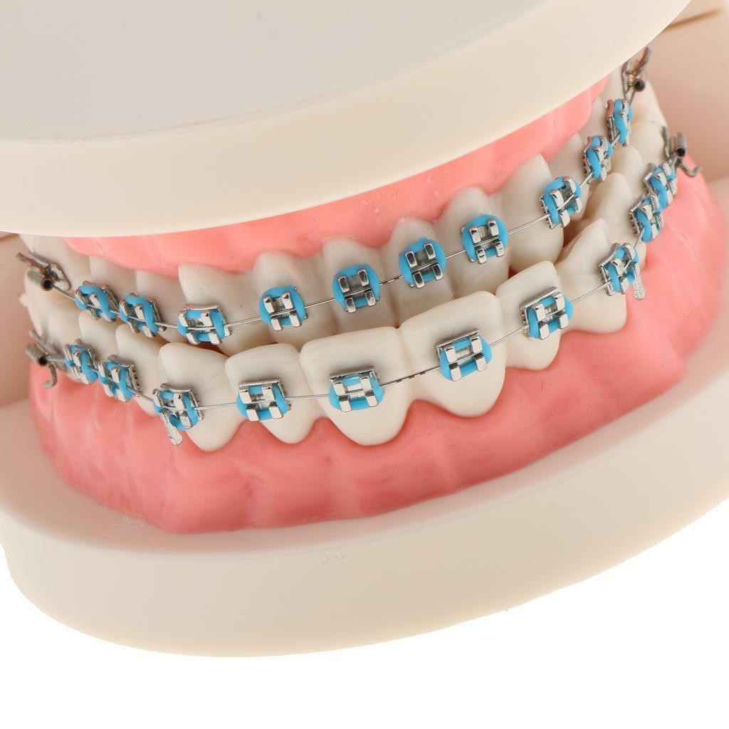 Dental Metal Model Orthodontic Adult Standard Teeth Hoop Brackets Ligature Tie